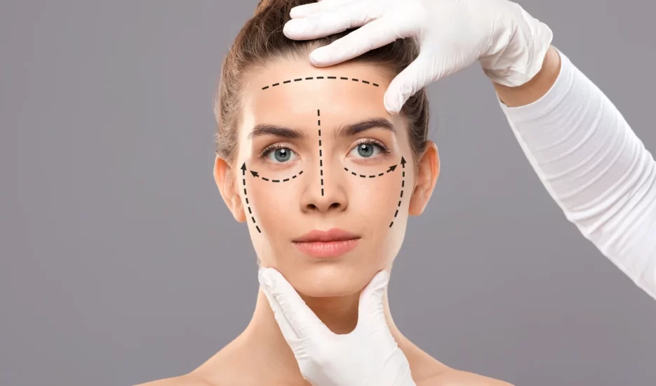 Ritidoplastia o Lifting Facial